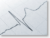 Ruhe-EKG, LZ-RR